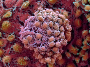 celulas madre embrionarias