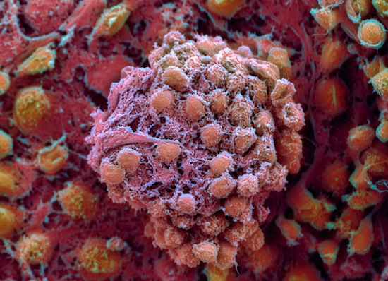 ¿Qué son las celulas madre embrionarias?